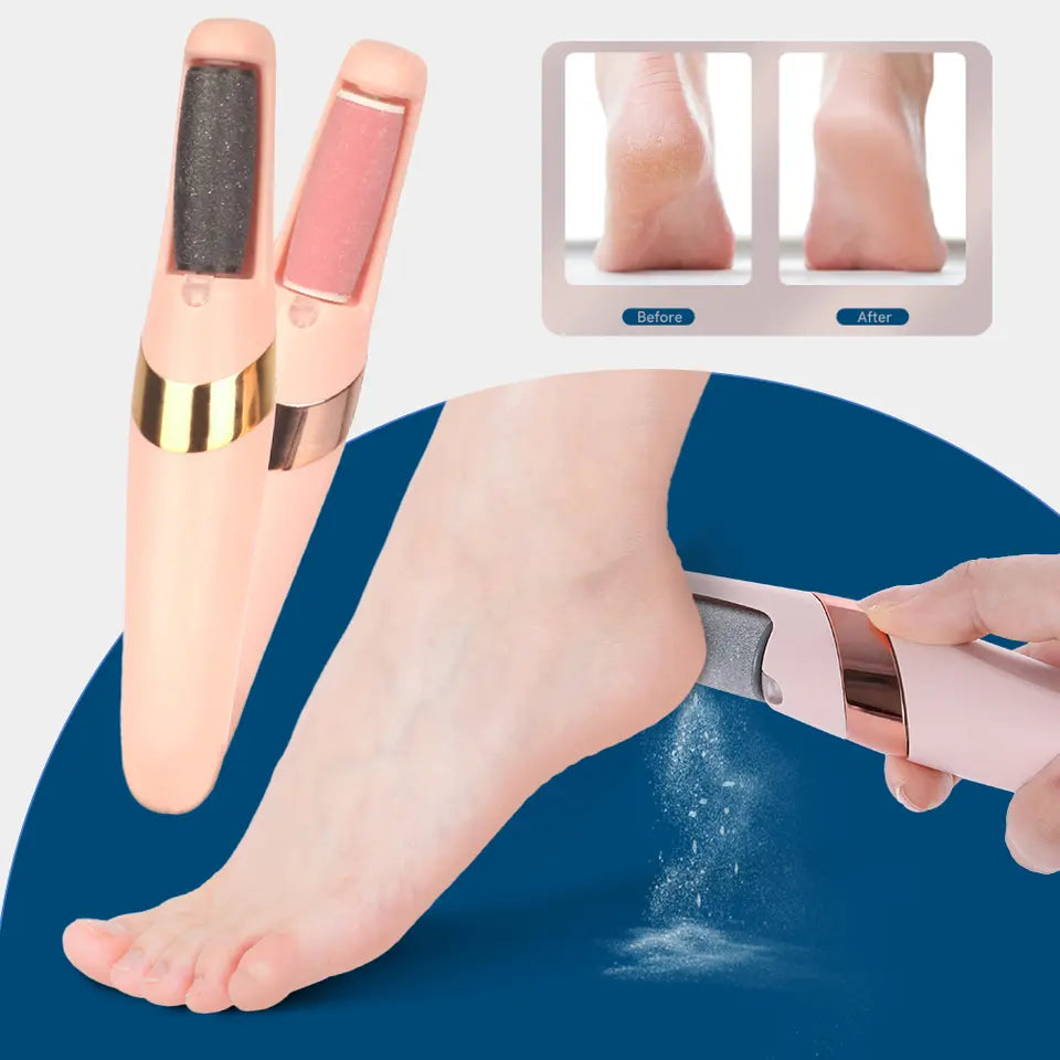 Rechargeable electric callus remover