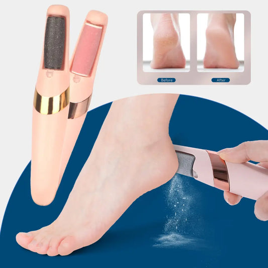 Rechargeable electric callus remover